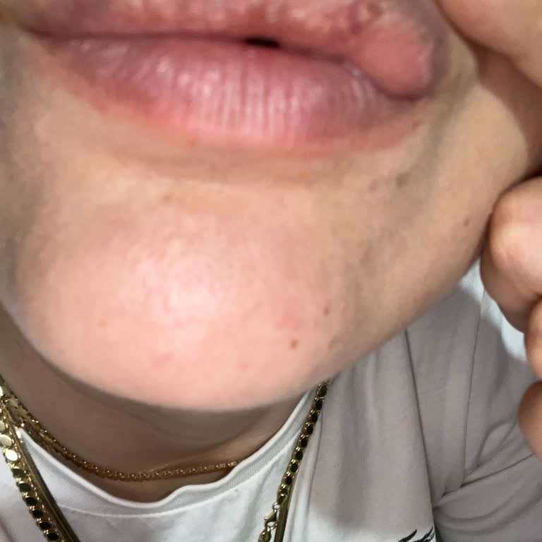 Yves Rocher Göz Makyaj Temizleme Suyu Ve Ruj Alerji Yaptı.