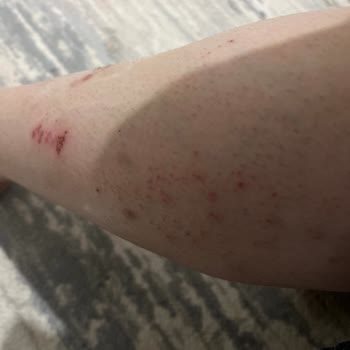 Sesu Ağda Vücut Ağdası