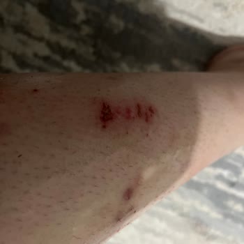 Sesu Ağda Vücut Ağdası