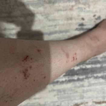 Sesu Ağda Vücut Ağdası