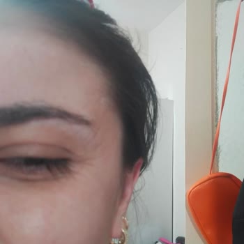 Estpoint Espoint Botoks Mağduriyeti