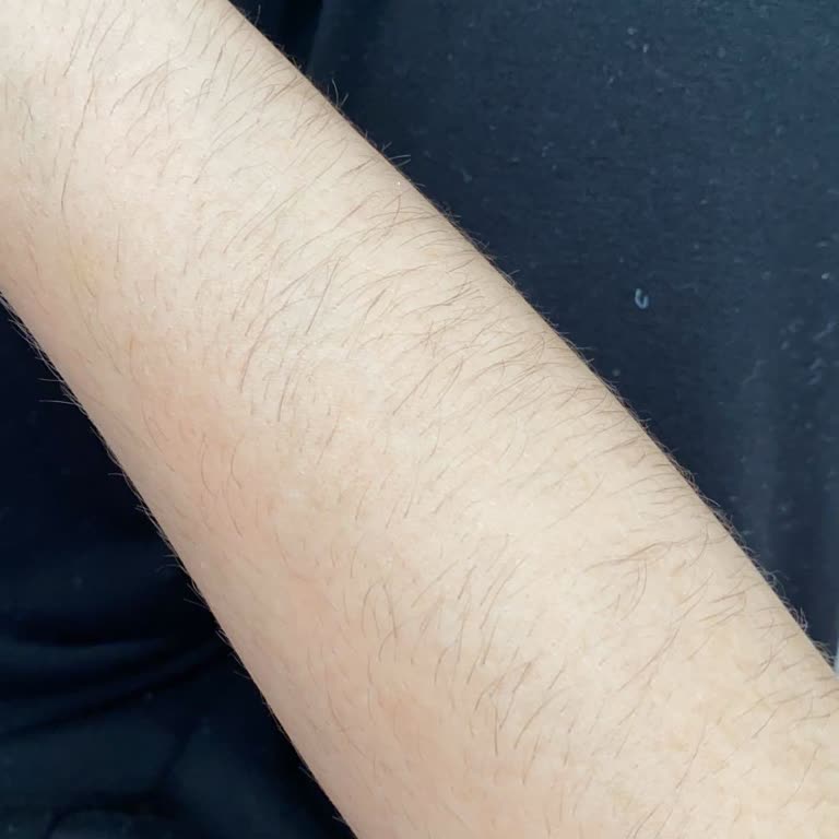 Esse Life Mezitli Memnun Kalmama Yeteri Kadar İlgilenmemeleri