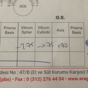 ERA Göz Sincan Göz Ölçüm Hatası