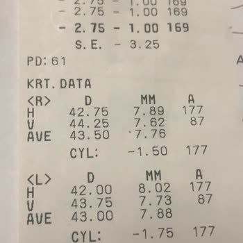 ERA Göz Sincan Göz Ölçüm Hatası