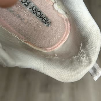 Skechers Ürünlerinin Arkasında Durmuyor Beni Aylarca Uğraştırdı