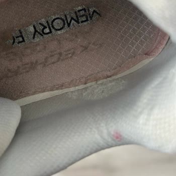 Skechers Ürünlerinin Arkasında Durmuyor Beni Aylarca Uğraştırdı