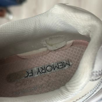 Skechers Ürünlerinin Arkasında Durmuyor Beni Aylarca Uğraştırdı