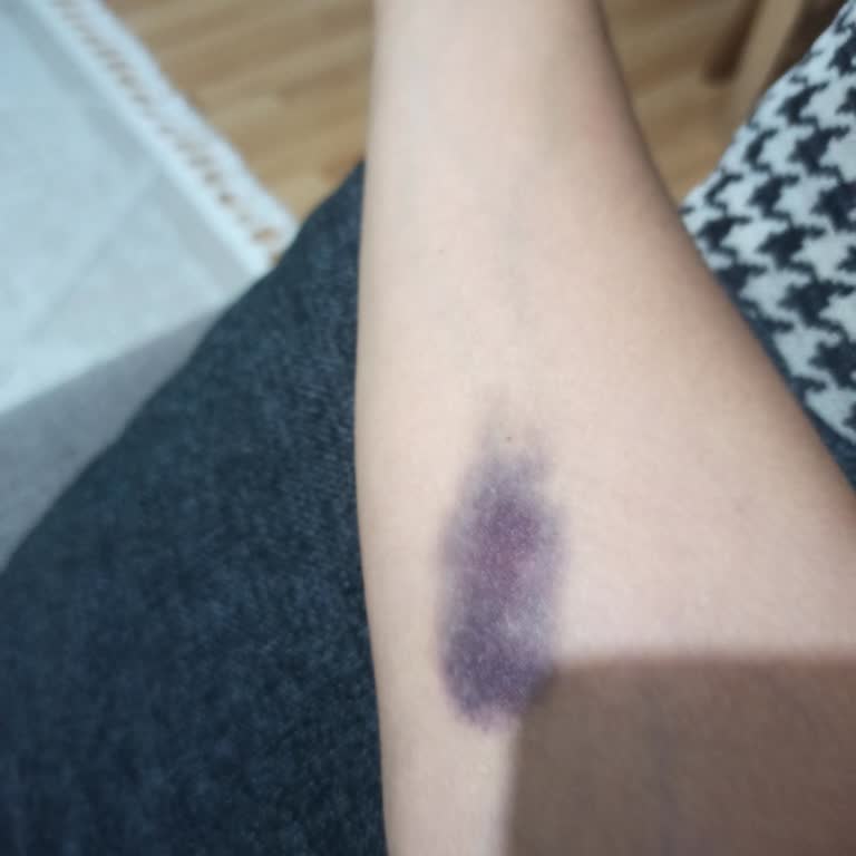 Medistate Kavacık Hastanesi Hemşireleri Damar Yolu Açamıyor