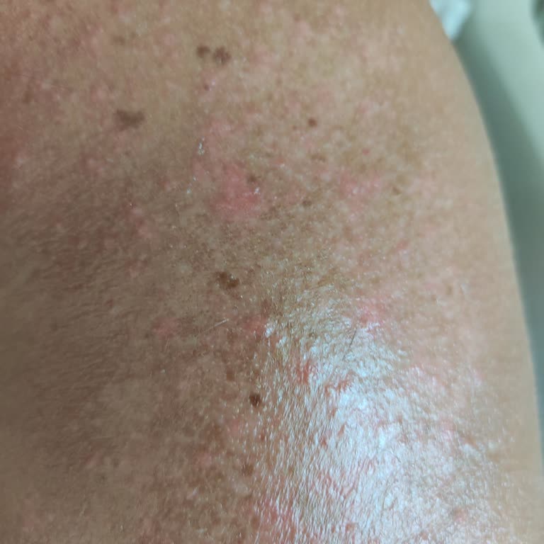 Cire Aseptine Fire Aseptine 50 Güneş Koruyucu (sözde)