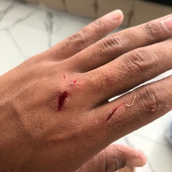 Ümit Cam Duşa Kabin Kapısı Patladı