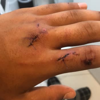 Ümit Cam Duşa Kabin Kapısı Patladı