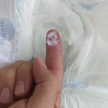 Molfix Bebek Bezi İçindeki Kristaller Deforme Olmuş. Pütür Pütür