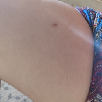 Siirt Golden Güzellik'ten Şikayetçiyim