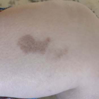 Siirt Golden Güzellik'ten Şikayetçiyim