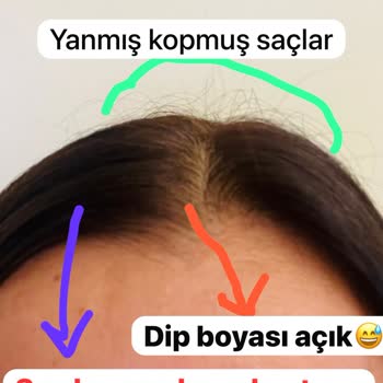 Hamza Ozan Ocak Hair Kuaför Deneyimim Ve Sonuçları