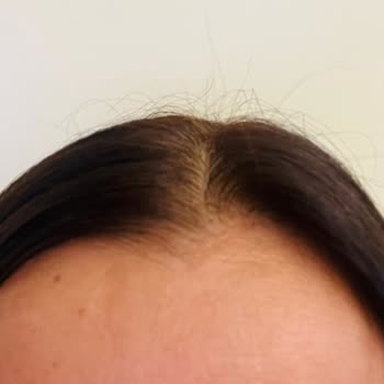 Hamza Ozan Ocak Hair Kuaför Deneyimim Ve Sonuçları