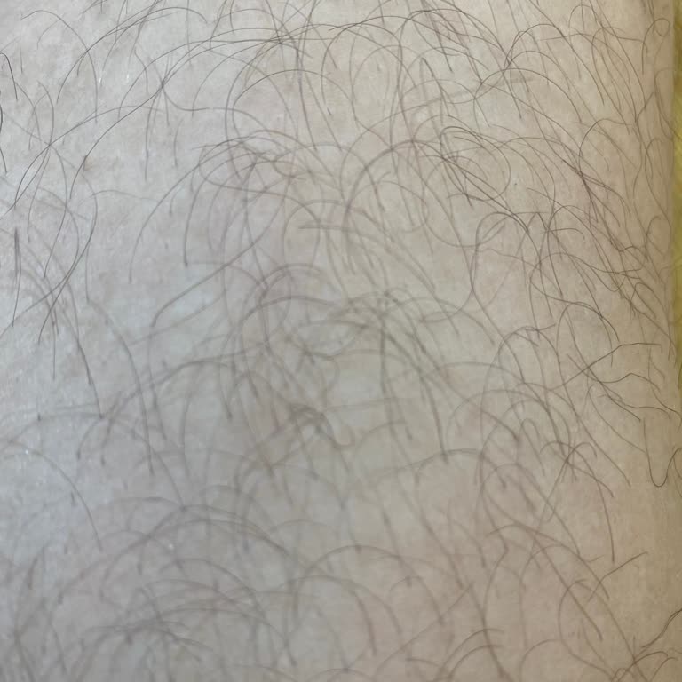 Suit Güzellik Merkezleri Suit FSM Güzellik Lazer