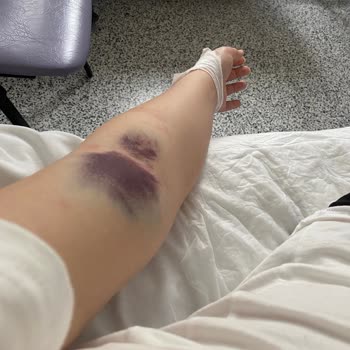 Meltem Hastanesi Hastane Sürecinde Yaşanan Sorunlar Ve Çelişkiler