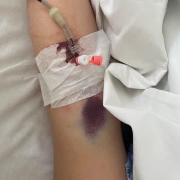 Meltem Hastanesi Hastane Sürecinde Yaşanan Sorunlar Ve Çelişkiler
