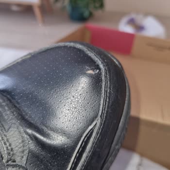 Skechers Ayakkabı 5 Ay İçerisinde Yırtıldı!