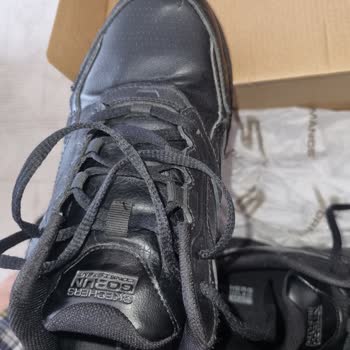 Skechers Ayakkabı 5 Ay İçerisinde Yırtıldı!