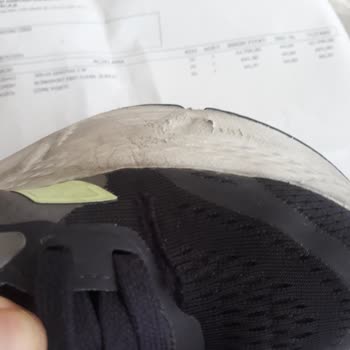 Adidas Ayakkabı Kalitesi Ve Müşteri Hizmeti Hayal Kırıklığı