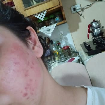 Esnaf ve Sanatkarlar Odası Yüzümün Derisini Kaldırdı