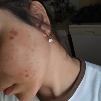 Esnaf ve Sanatkarlar Odası Yüzümün Derisini Kaldırdı