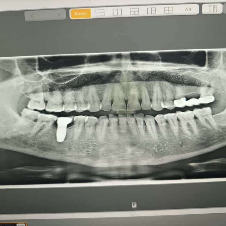 Egemen Esen Diş Kliniği Dolgu İmplant Ve Asistanlar