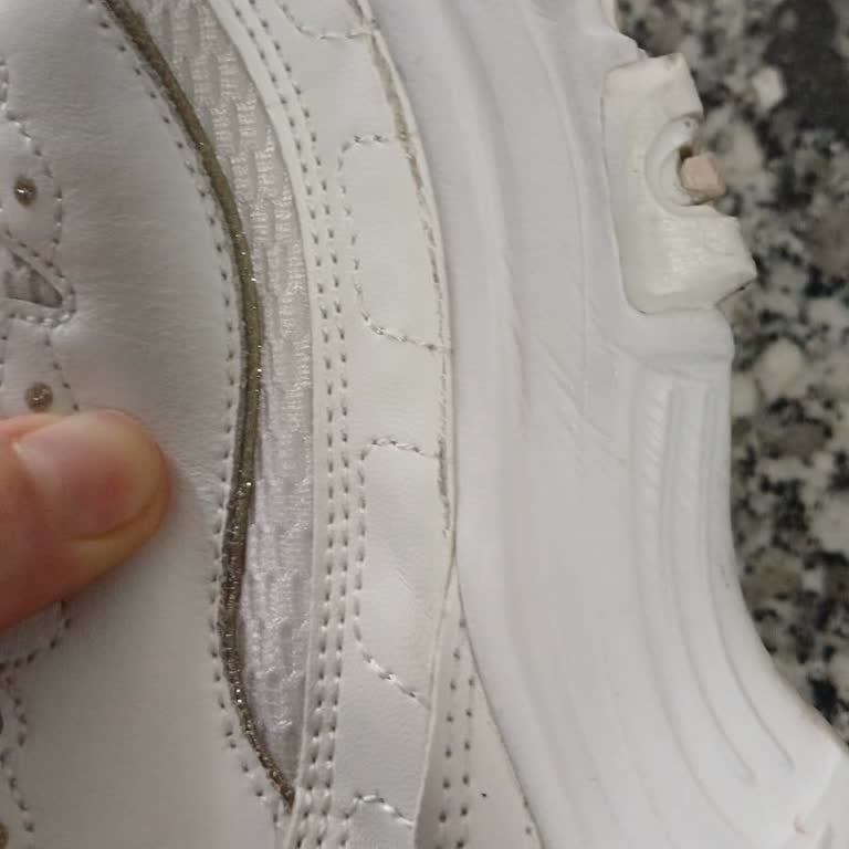 SuperStep Skechers Ayakkabıda 10 Ayda Deformasyon Ve Garanti Sorunu