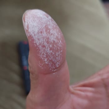 Vanish Kosla Ellerimi Yaktı. Asit Mi Bu Yoksa Leke Çıkarıcı Mı?