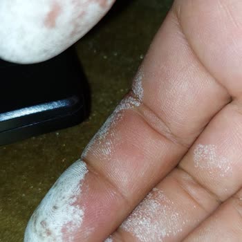 Vanish Kosla Ellerimi Yaktı. Asit Mi Bu Yoksa Leke Çıkarıcı Mı?