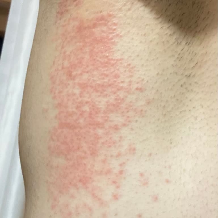 Veet Tüy Dökücü Krem Pişmanlığı!