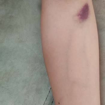 İstinye Medical Park GOP Hastanesi İş Bilmez Hemşiresi