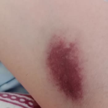 İstinye Medical Park GOP Hastanesi İş Bilmez Hemşiresi