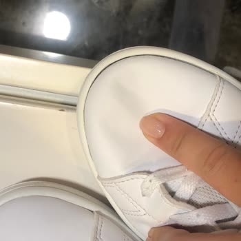 Adidas' Tan Almış Olduğun Ayakkabının Kısa Sürede Deforme Olması