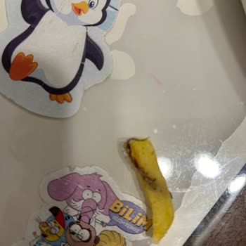 Köfteci Yusuf Patatese Saç Yapışmıştı!