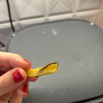 Köfteci Yusuf Patatese Saç Yapışmıştı!