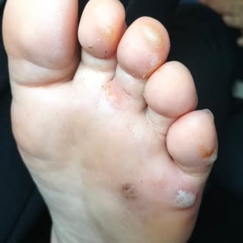 Rituel De Beaute Ayağımda Mantara Sebep Oldu