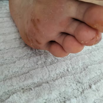 Rituel De Beaute Ayağımda Mantara Sebep Oldu