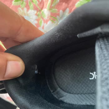 Skechers Ayakkabı Deformasyonu İle İlgili