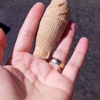 Elitium Tıp Merkezi Acilde Doktor Geldi Gözünün Kenarıyla Baktı Pansuman Yapılsın Dedi