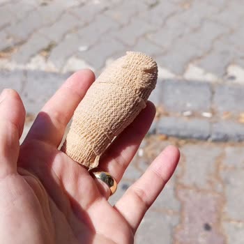 Elitium Tıp Merkezi Acilde Doktor Geldi Gözünün Kenarıyla Baktı Pansuman Yapılsın Dedi