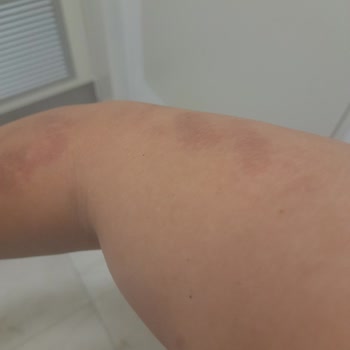 Monalisa Sağlıklı Güzellik Lazer Epilasyon Seansı