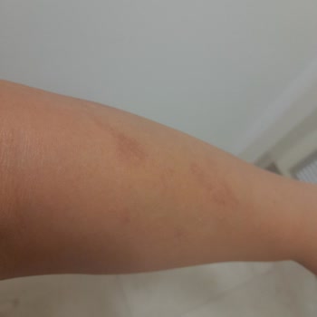 Monalisa Sağlıklı Güzellik Lazer Epilasyon Seansı