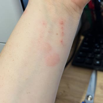 Vivense Koltuk Takımında Tahta Kurusu