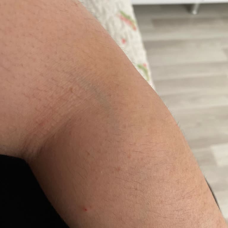 Suit Güzellik Merkezleri İskenderun Suit Güzellik Merkezine