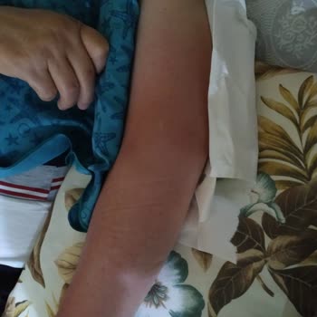 Akdeniz Üniversitesi Hastanesi Onkoloji Bölümünde Mağduriyet