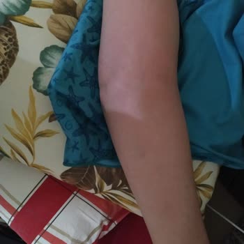 Akdeniz Üniversitesi Hastanesi Onkoloji Bölümünde Mağduriyet