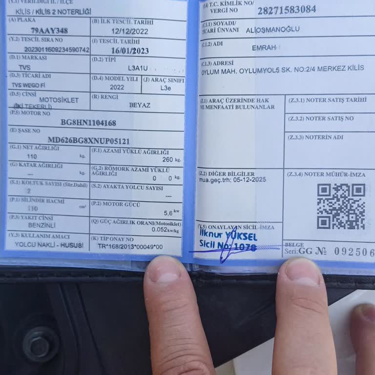 TVS Motor Motordan Şakır Şakır Ses Gelmesi